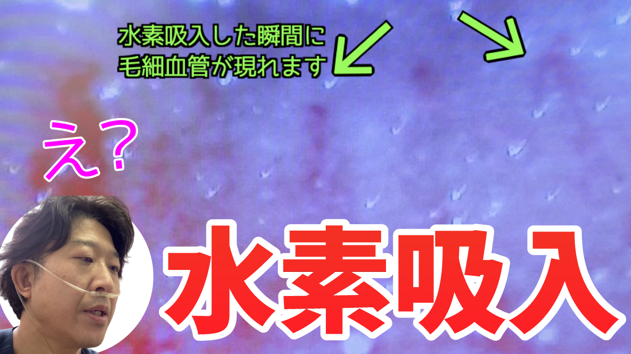 水素吸入すると血流はどうなるか？ | 水素サロン LIFE